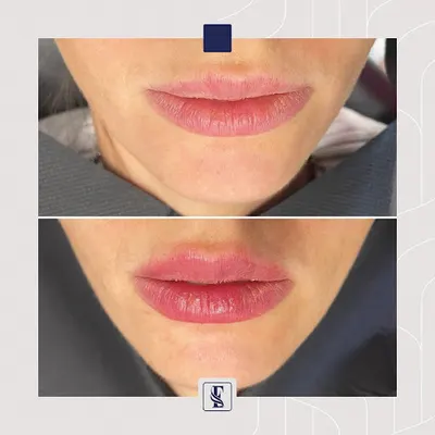 Medycyna Estetyczna Estetica - Kosmetolog, Masaż Kobido, Mezoterapia - Gabinet Medycyny Estetycznej Gliwice